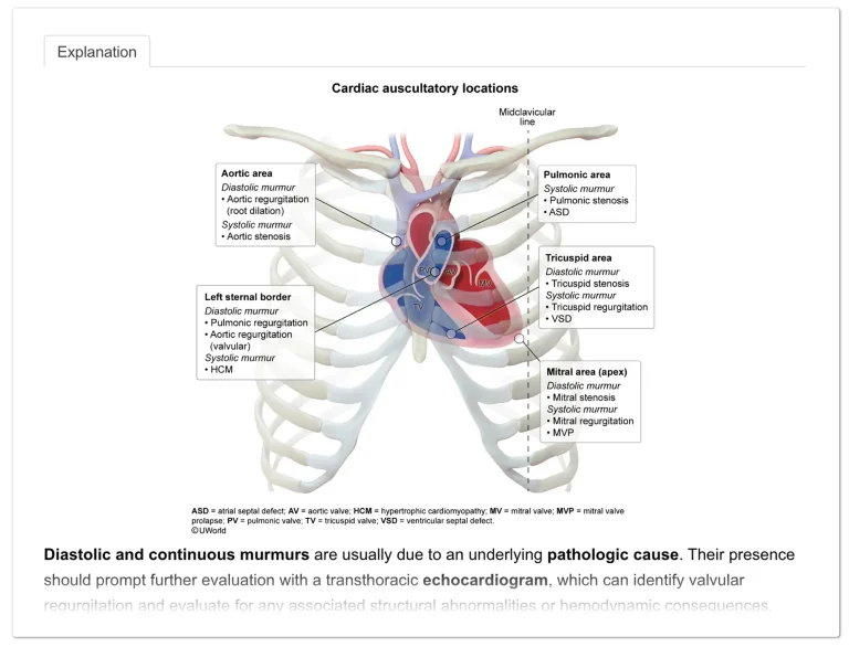 UWorld AKT Practice Question explaining Cardiac auscultatory locations