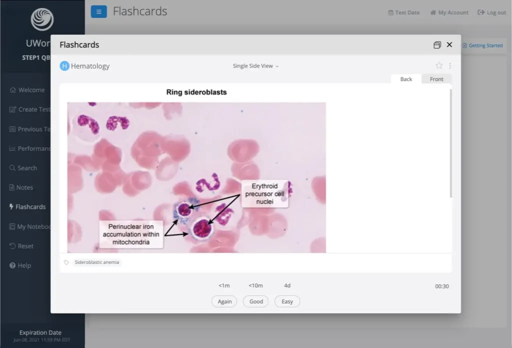 UWorld USMLE flashcards feature with spaced-repetition technology