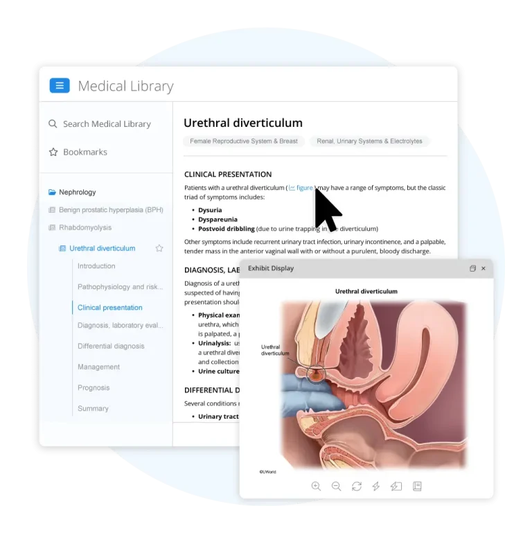 Realistic illustrations of Urethral diverticulum