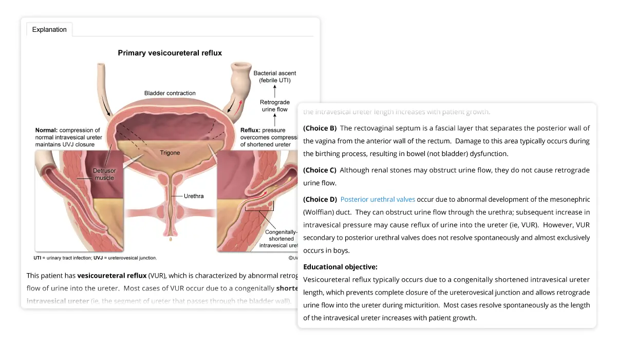 A detailed UWorld USMLE Step 1 question explanation component breakdown