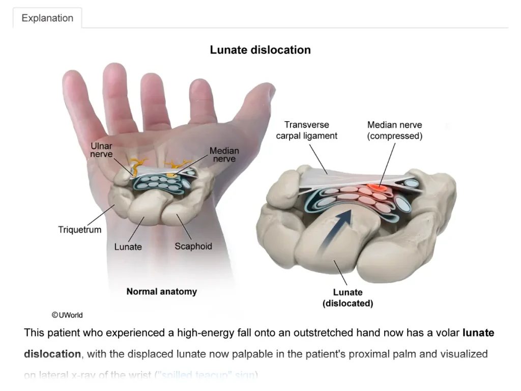 Step 1 practice question with correct answer choice selected