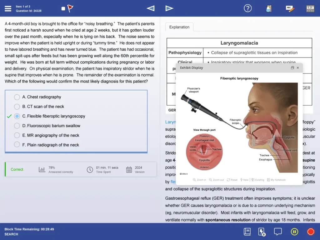 UWorld USMLE Step 2 CK practice question & detailed explanation featuring Laryngomalacia