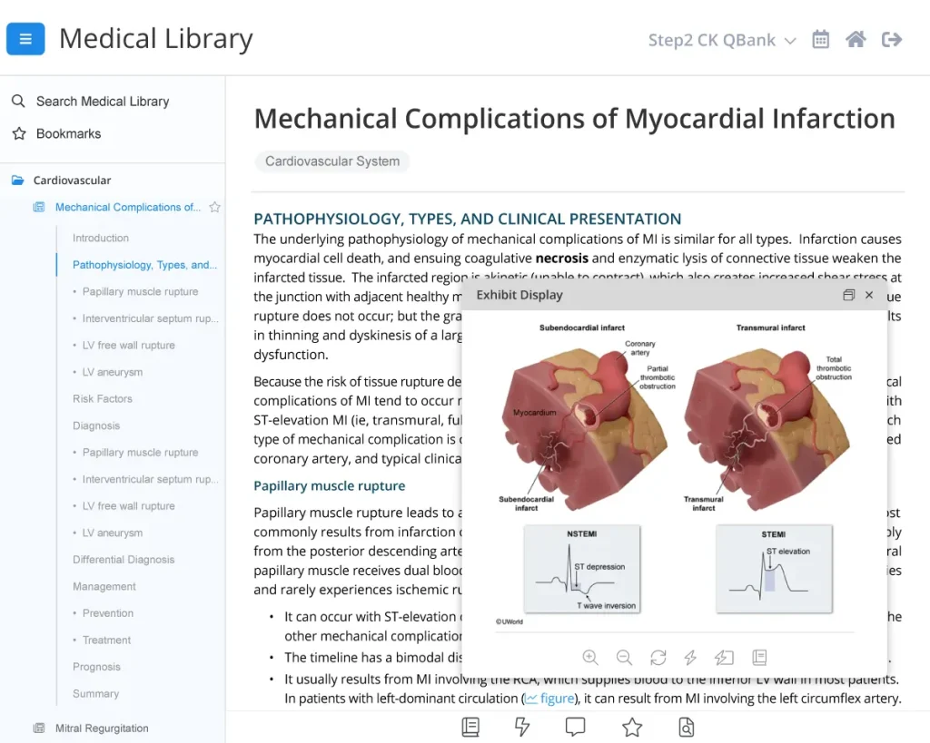 UWorld Medical Library in-text hyperlinks and exhibit display for Myocardial infarction